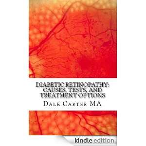 Diabetic Retinopathy: Causes, Tests, and Treatment Options: Dale 