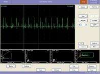 PC based 4 Channel EMG/EP Measuring System Neurology GM  