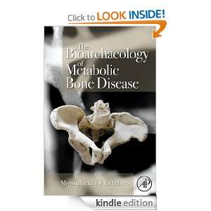 The Bioarchaeology of Metabolic Bone Disease Megan Brickley  