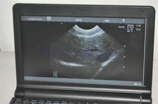 CE Proved Digital Portable Laptop Ultrasound Scanner w Convex Probe 
